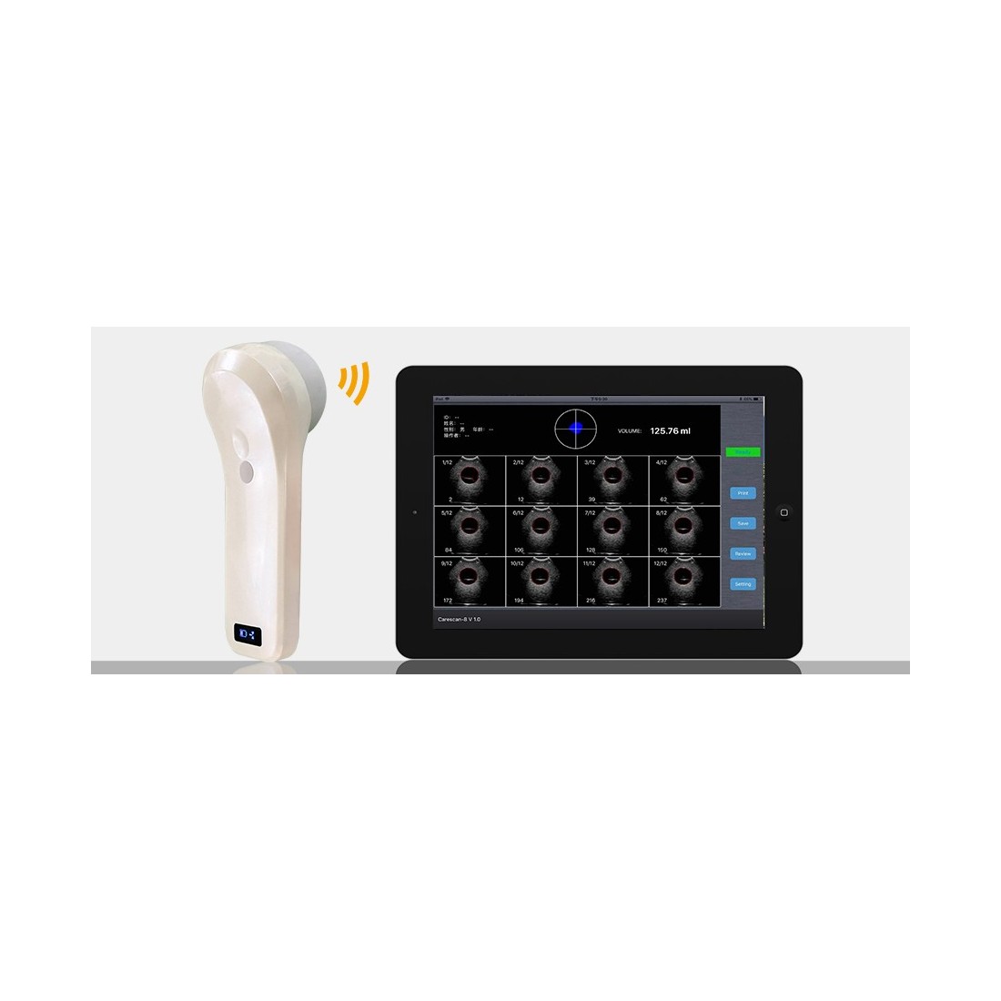Bladder Scanner Portable - Android/IOS/Windows | Logiciel MedConnect