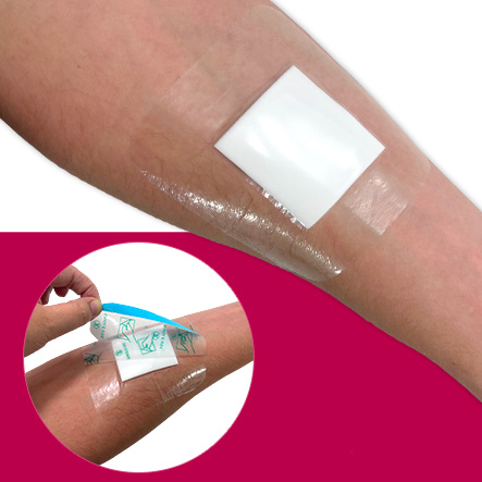 Pansement hydrocellulaire avec bordure adhésive - Wayfoam Border - Robemed