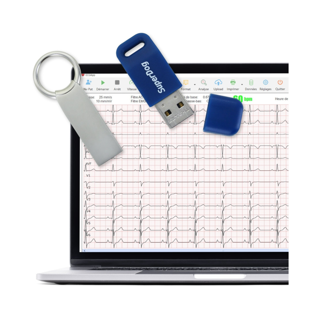 Logiciel pour PC-ECG/Cardiomate - Electrocardiographe numérique - Spengler