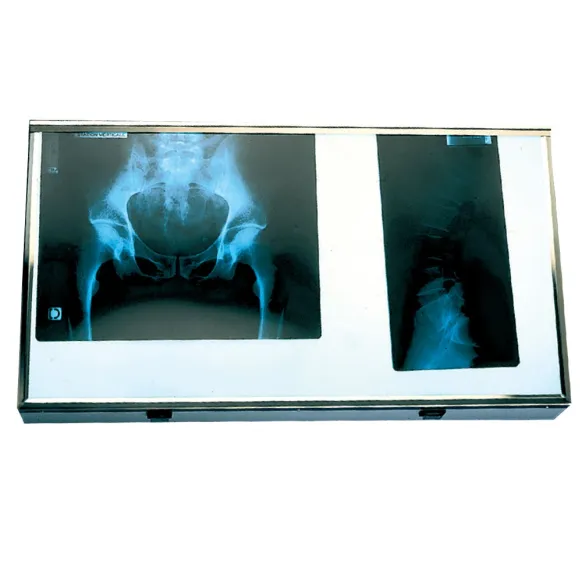 NÉGATOSCOPE 2 PLAGES