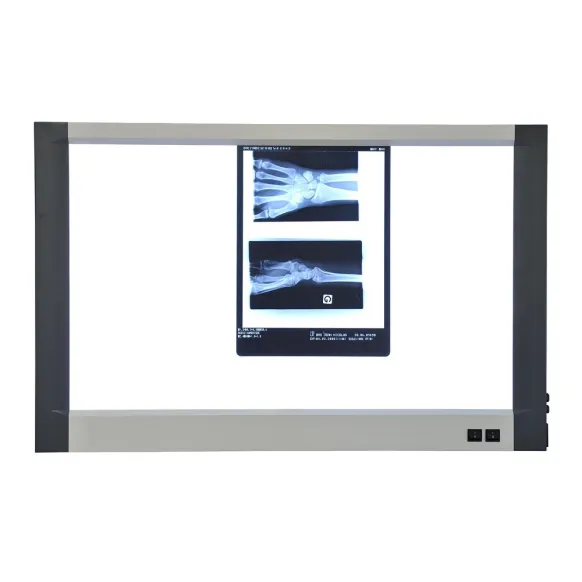 NÉGATOSCOPE LED EXTRA-PLAT 2 PLAGES 