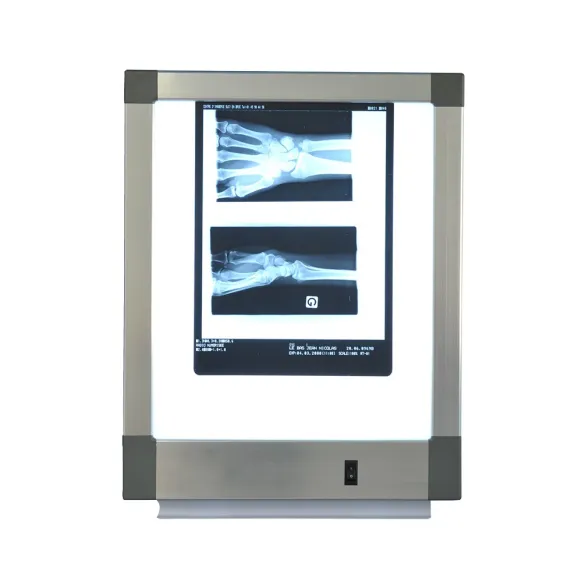 NÉGATOSCOPE LED EXTRA-PLAT 1 PLAGE