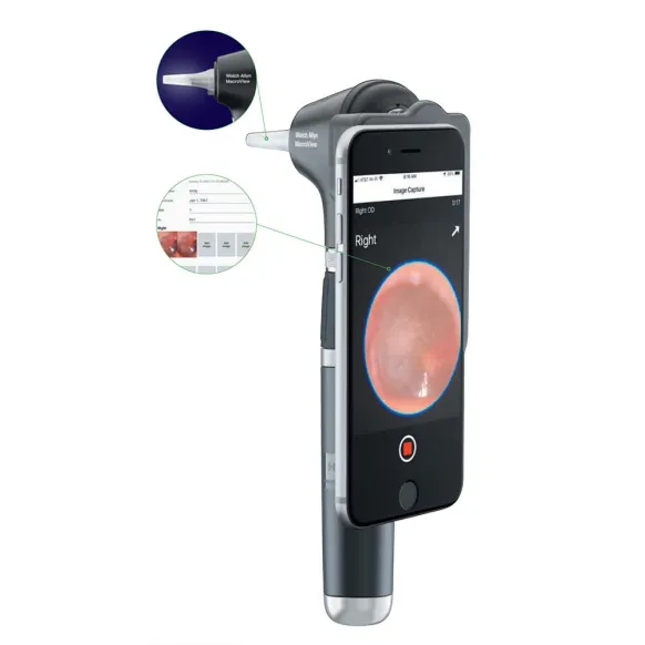 OTOSCOPE MACROVIEW 2 PLUS IEXAMINER