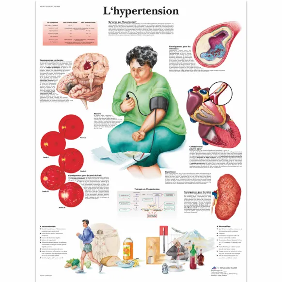 PLANCHES ANATOMIQUES HYPERTENSION