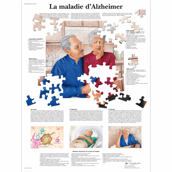 PLANCHES ANATOMIQUES MALADIE D'ALZHEIMER