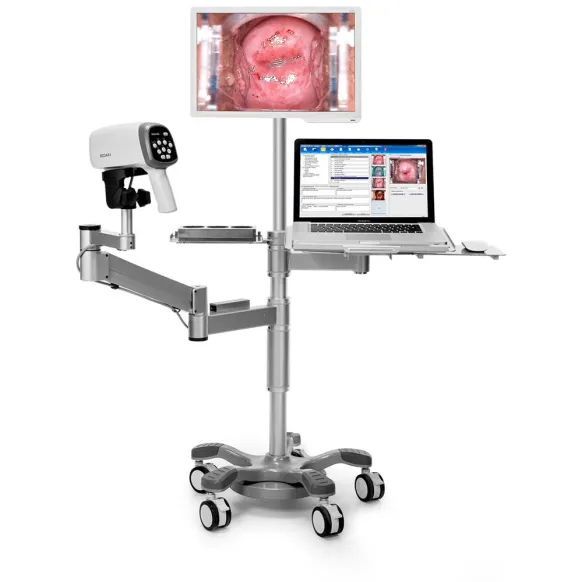 VIDÉO COLPOSCOPE C6A + PIED + BRAS ARTICULE + PLATEAU